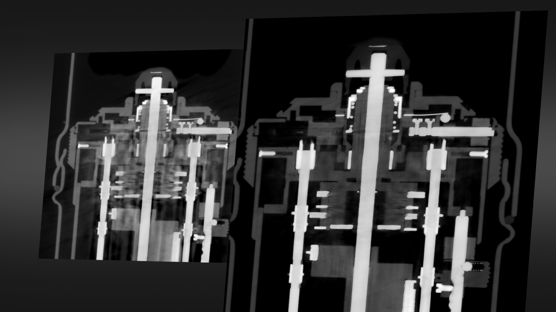 高级混合材料伪影减少（AMMAR）