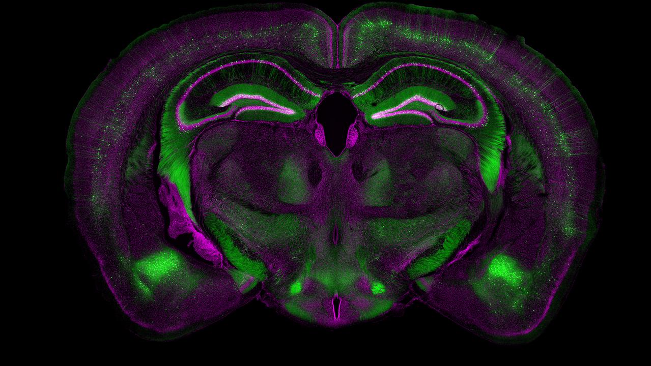 小鼠大脑，ZEN Connect应用实例 Jochen Herms | 慕尼黑大学 | 德国