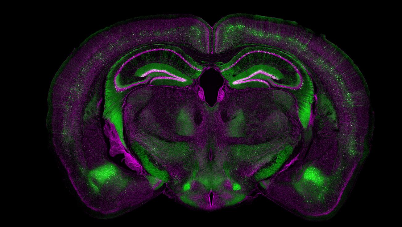 小鼠大脑，ZEN Connect应用实例