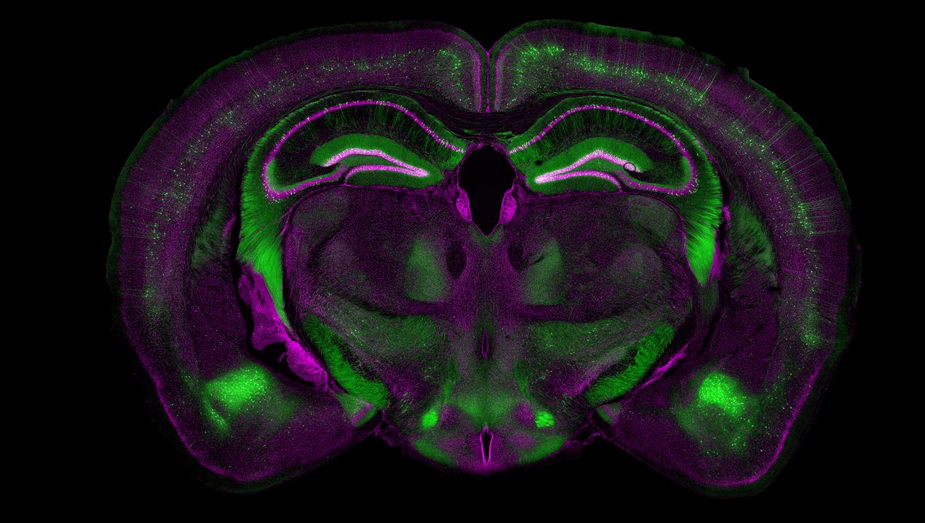 小鼠大脑，ZEN Connect应用实例