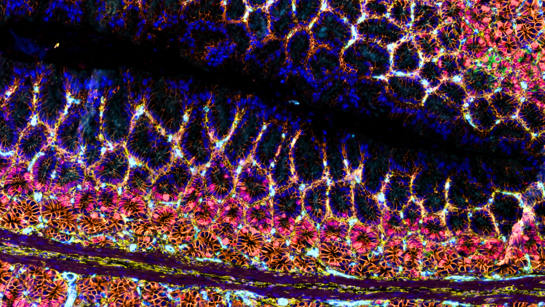 HCT-116-GFP（结肠癌）/NIH-3T3-RFP（成纤维细胞）共培养细胞的透明化细胞团，细胞核用Hoechst染色。在InSphero Akura培养板上成像。使用arivis Pro对数据集进行分割。