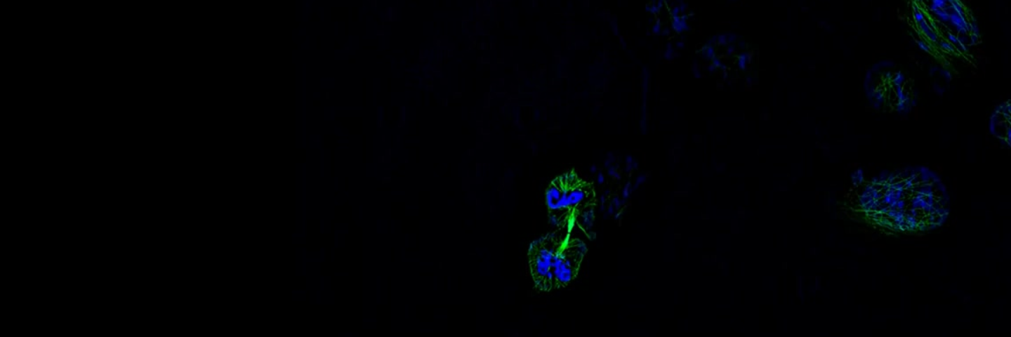 Cos-7细胞微管（α-微管蛋白抗体Alexa Fluor 488，绿色）和细胞核（Hoechst，蓝色）染色的完整Z轴序列图像，显示了SIM² Apotome模式出色的切片能力。物镜：LD LCI Plan-Apochromat 25× / 0.8 Imm Corr