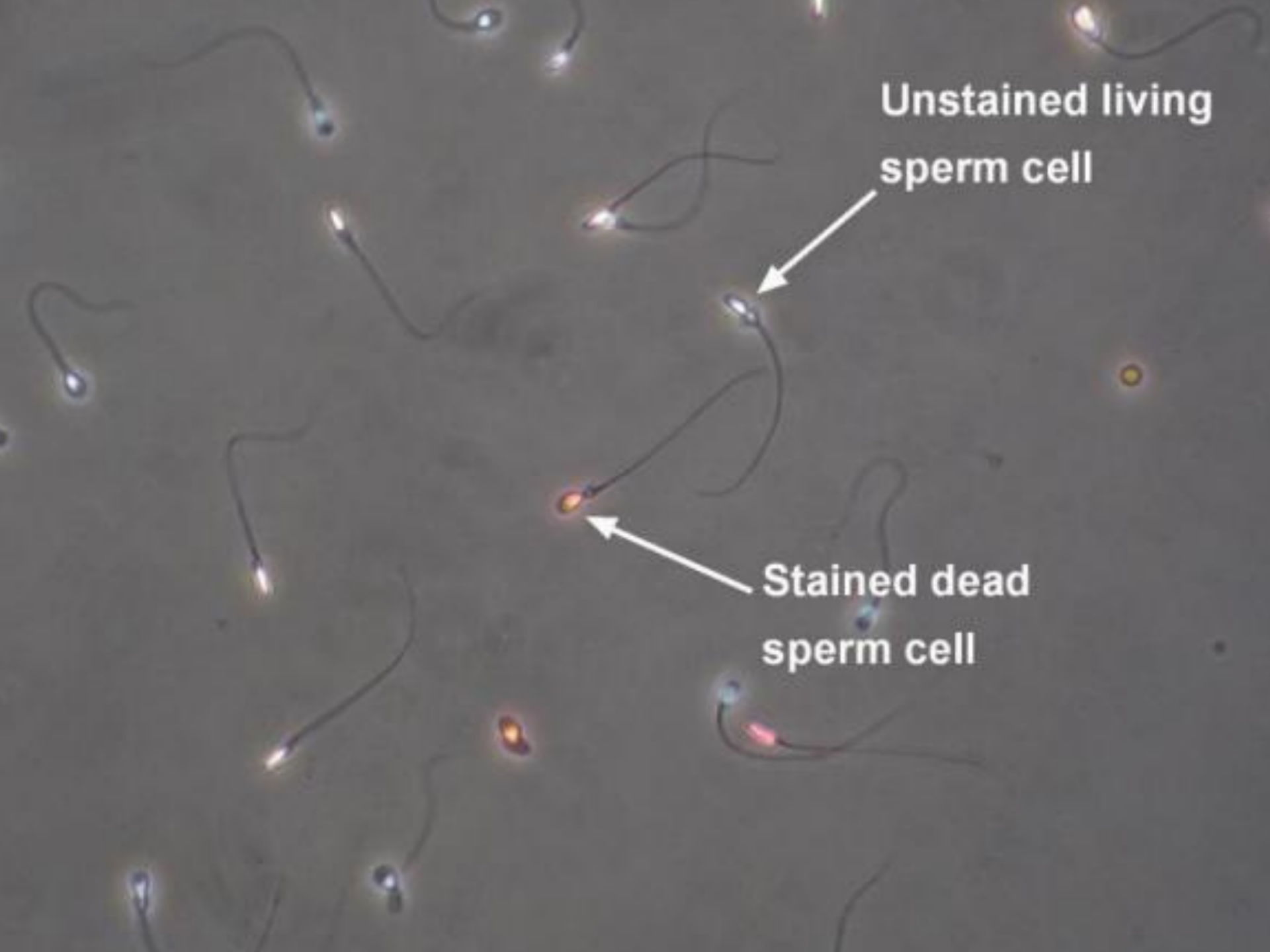 伊红Y染色检测静止精子的活力