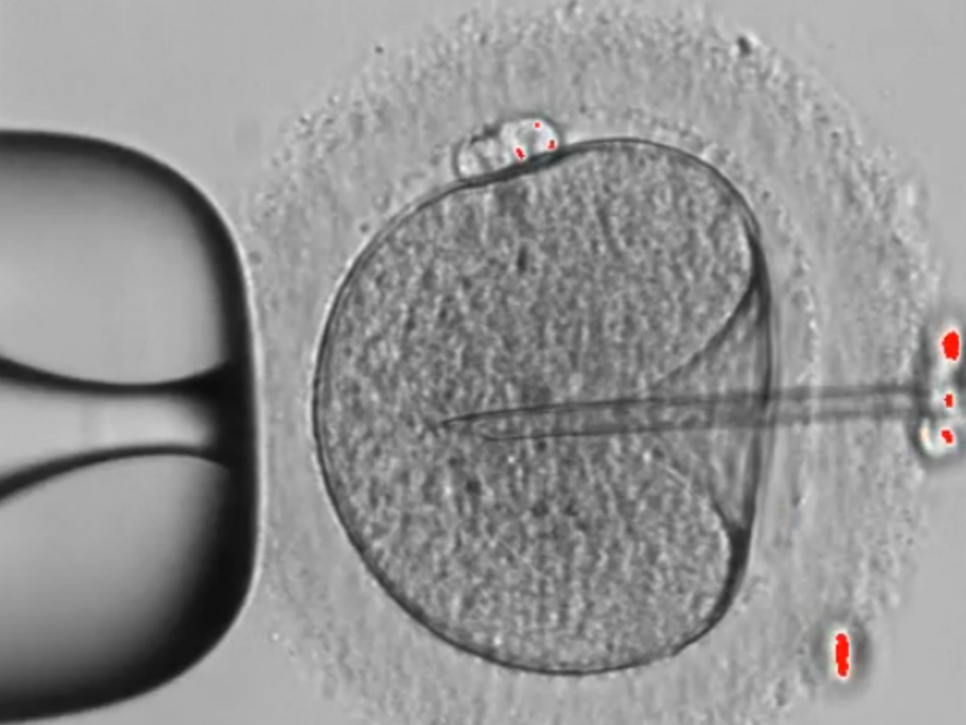  辅助生殖技术（亚太地区）