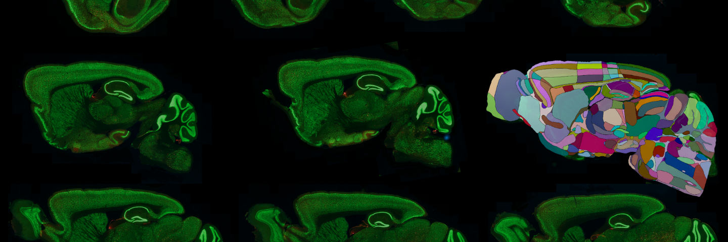 脑图谱自动对齐和tau斑块识别