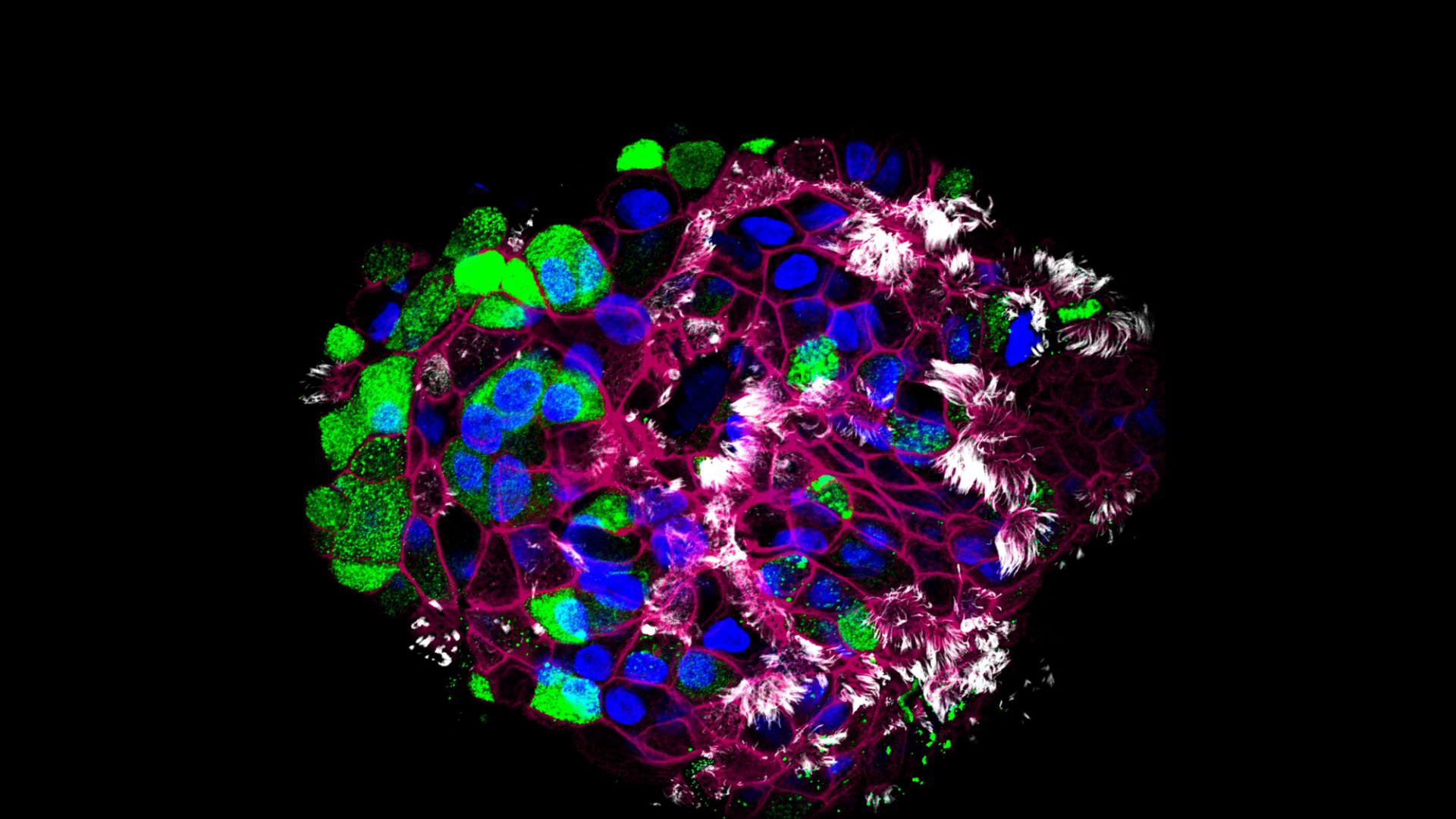 人体远端肺脏类器官显示棒状细胞和纤毛细胞，暴露在外10天。