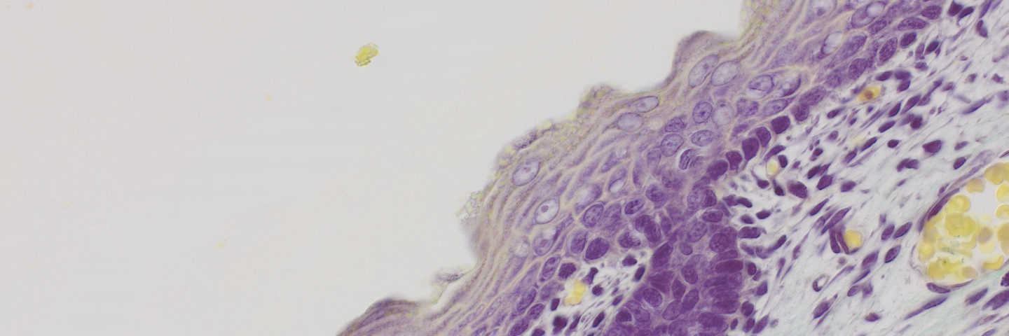 明场_人体皮肤_Axiocam-212-color