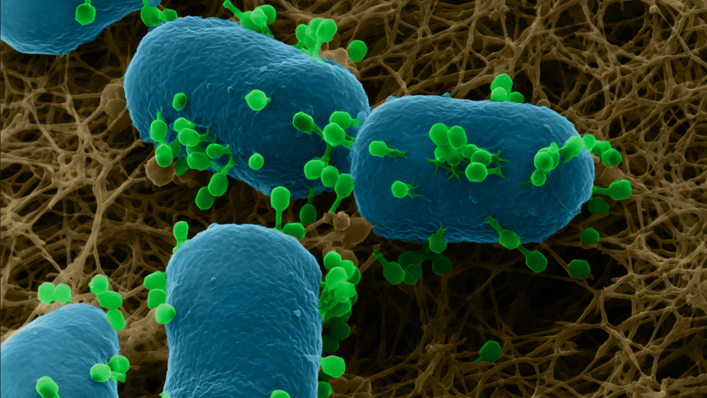 借助这一系统进行研究，可以深入了解病毒与细菌在细菌培养皿上的相互作用。