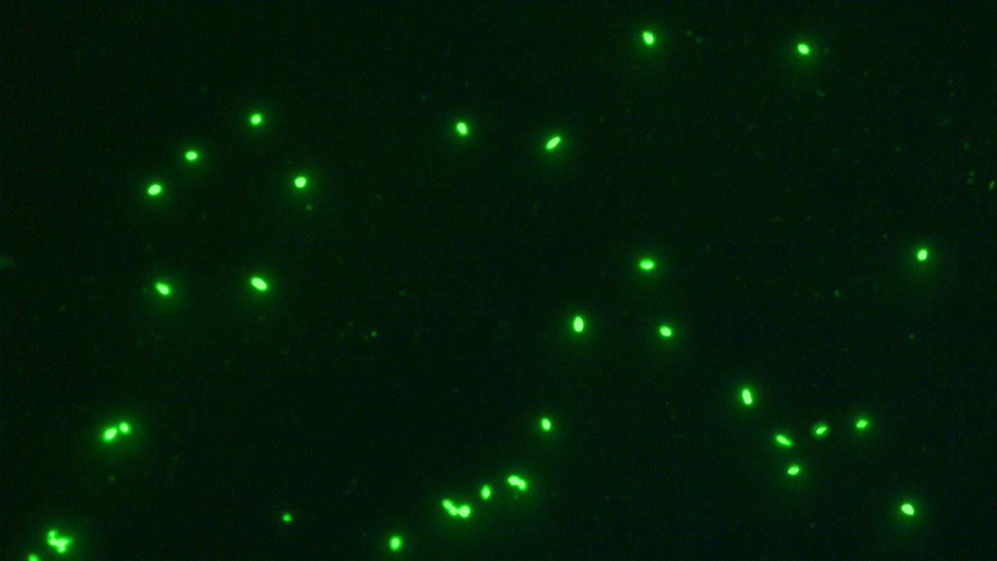 样品1，精子用HY-Liter 染色，绿色荧光，Alexa，使用Axio Scope.A1采集，物镜：40×，法医