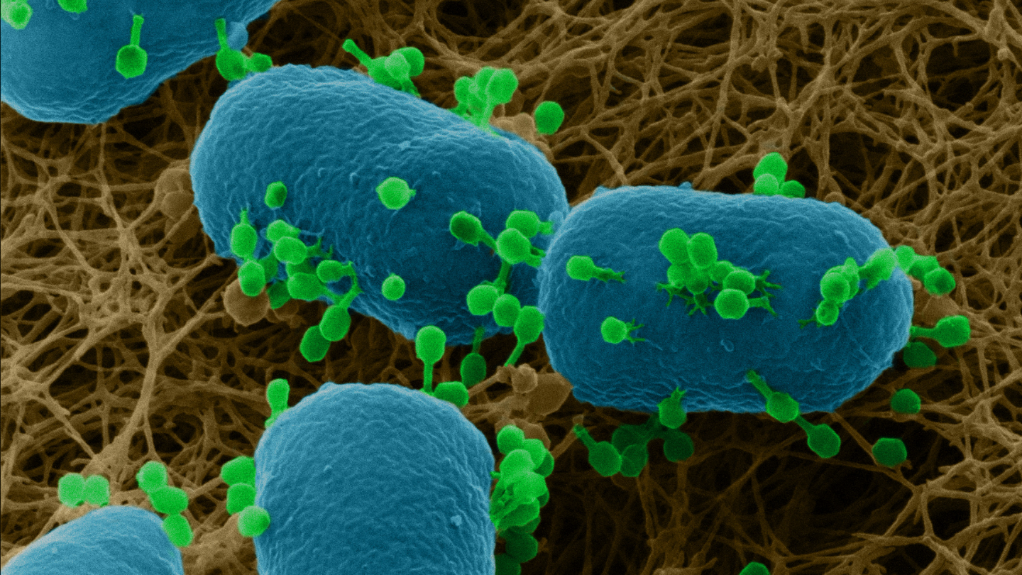 使用NanoFab系统的特殊之处在于可以对未涂层的生物样品进行亚纳米分辨率成像。借助这一系统进行研究，可以深入了解病毒与细菌在细菌培养皿上的相互作用。