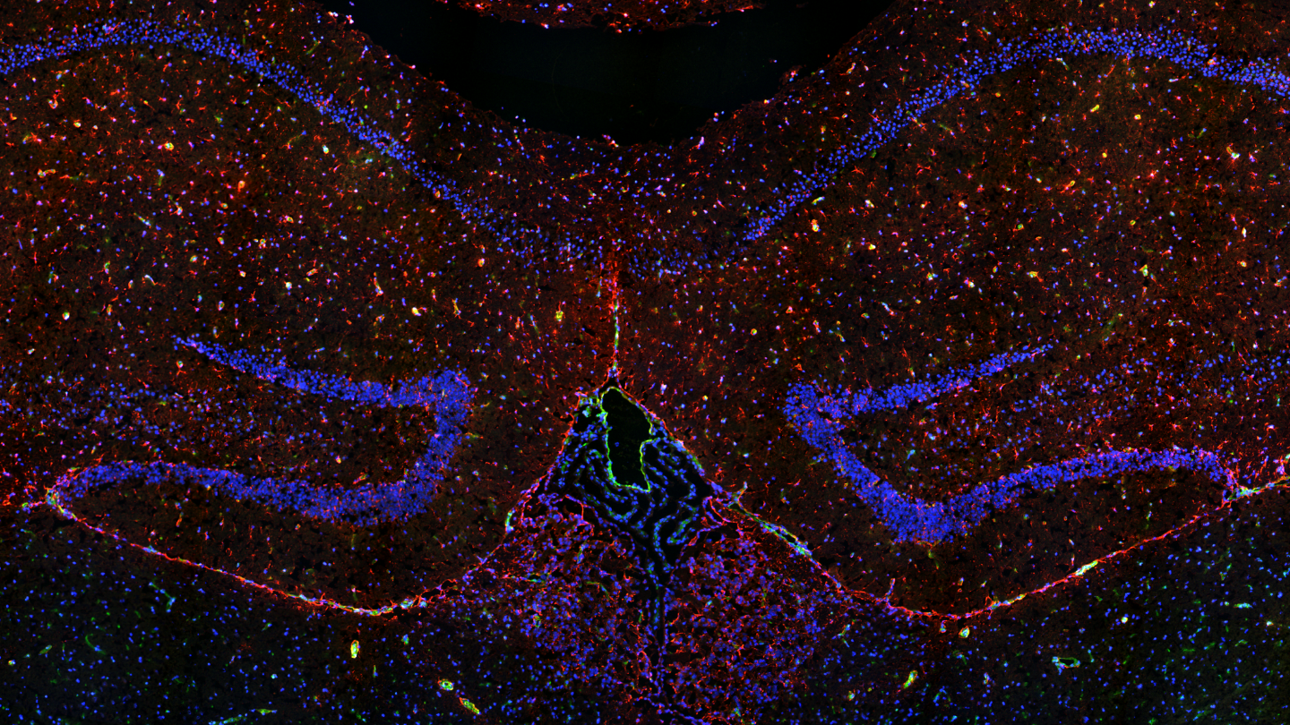 小鼠大脑，5 μm低温切片，qDOT标记：DAPI、CD31（内皮细胞）；GFAP（星形胶质细胞）