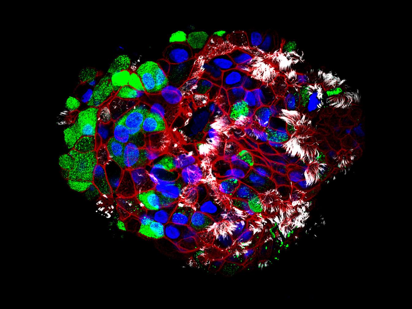 人体远端肺脏类器官显示棒状细胞和纤毛细胞，暴露在外10天。