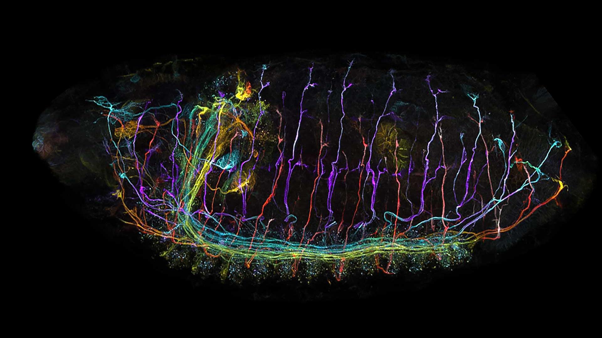 Drosophila ZEN Connect 1-01-Airyscan Processing-01-Stitching-02-Color-coded Projection-04-2.tif