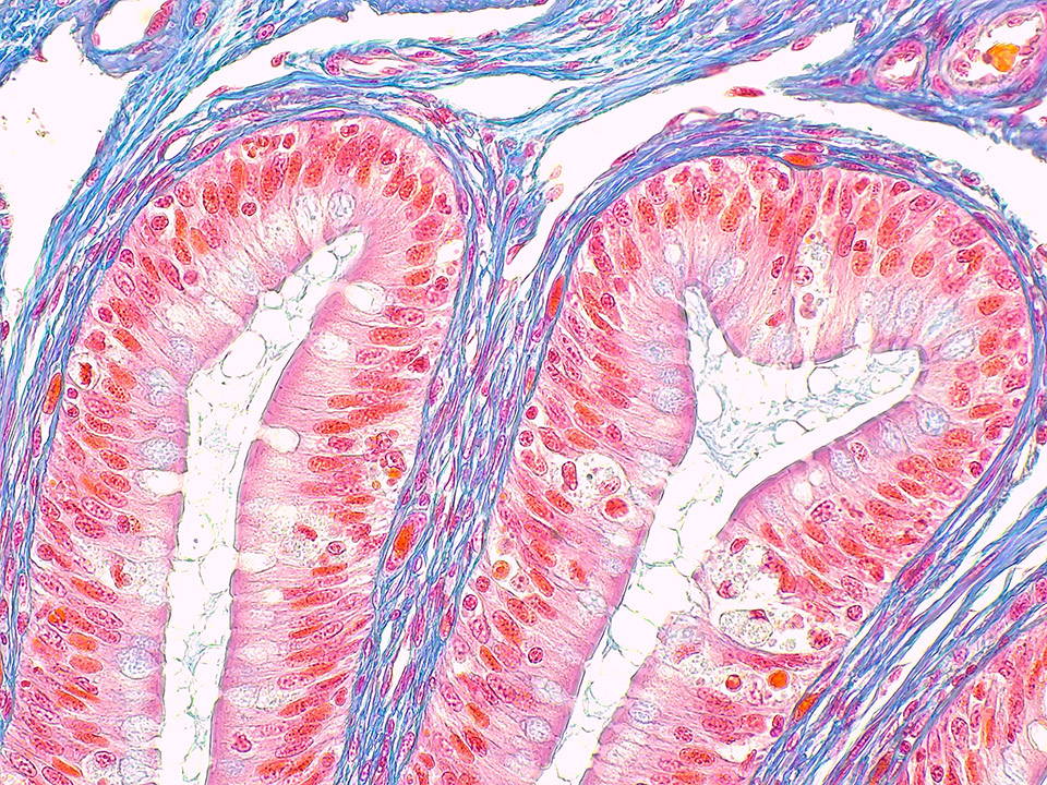 Primostar 3相机，配备iPlan Achromat 40×：蛙（明场，高分辨率拍摄）
