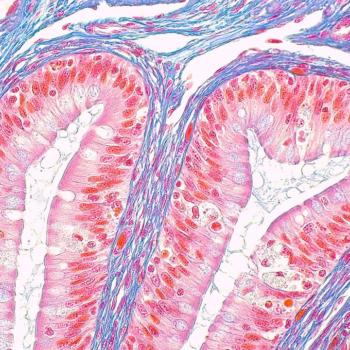 Primostar 3相机，配备iPlan Achromat 40×：蛙（明场，高分辨率拍摄）