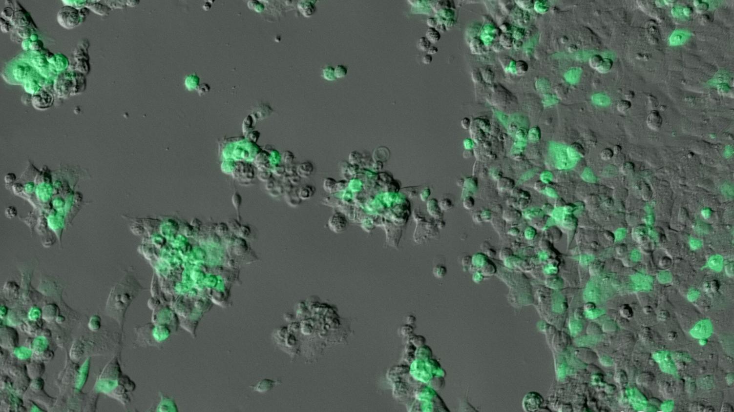 GFP HEK（人胚胎肾）细胞。1 mm塑料底成像；每5分钟拍摄一次，连续拍摄5天。