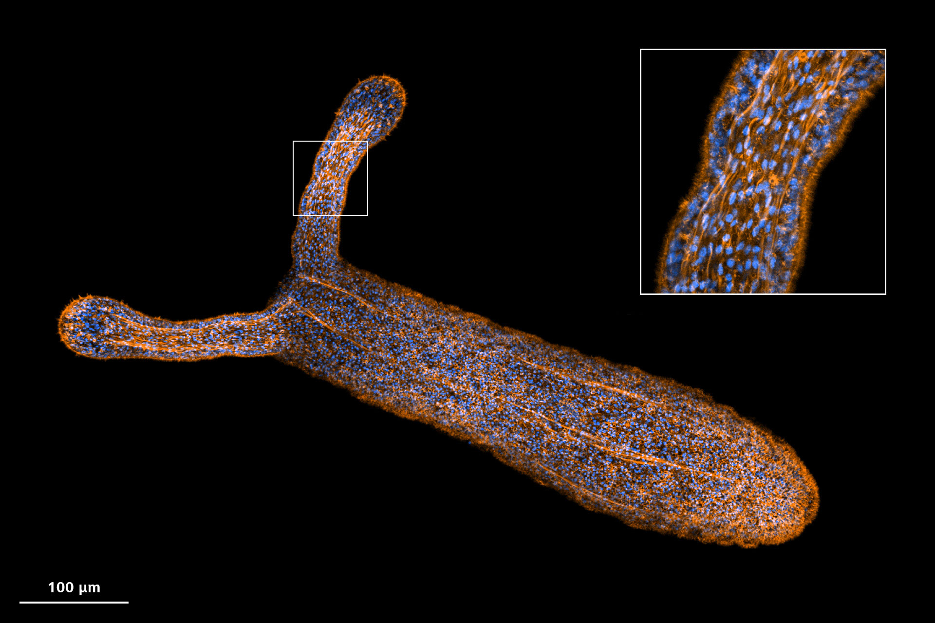 使用Airyscan 2高灵敏度模式成像的小星海葵（Nematostella vectensis）。