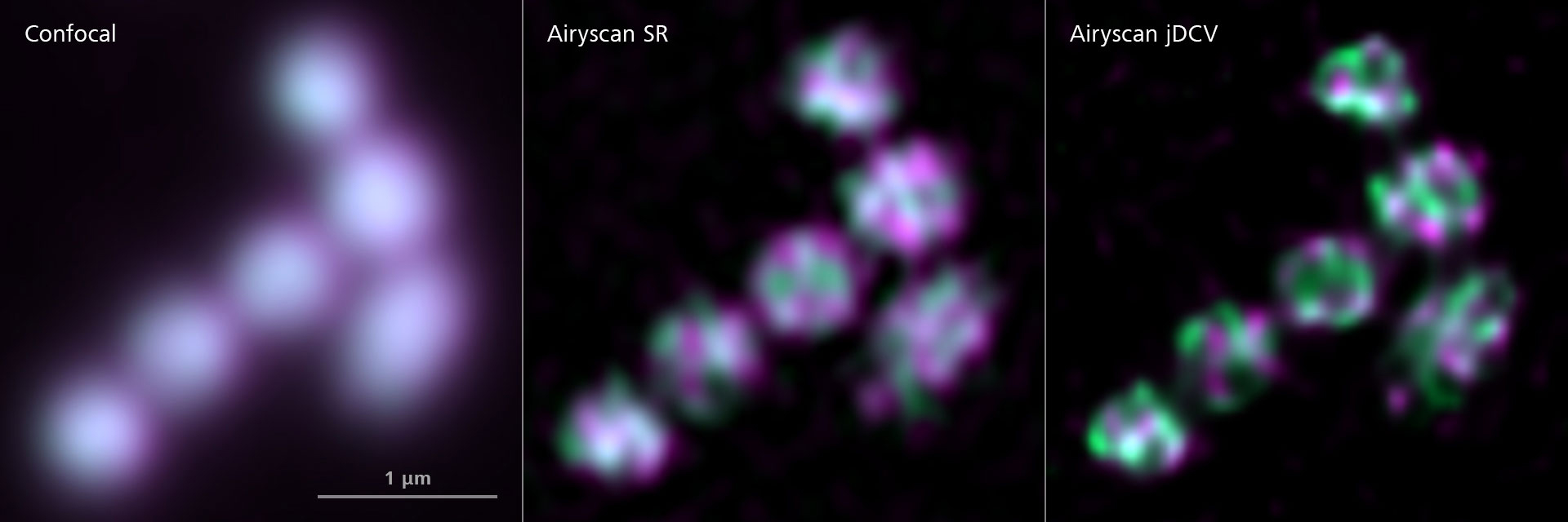 拟南芥细胞中的线粒体。共聚焦成像与Airyscan SR以及Airyscan jDCV的比较。由德国明斯特大学Schwarzländer工作小组的J.-O. Niemeier提供。