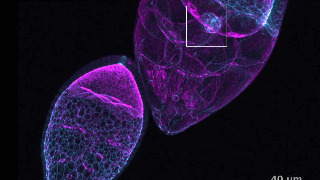 三维类器官、亚细胞结构（上皮细胞层和内腔）。研究Wnt信号在类器官形成中的作用。使用蔡司Celldiscoverer 7共聚焦扫描仪和Airyscan采集。