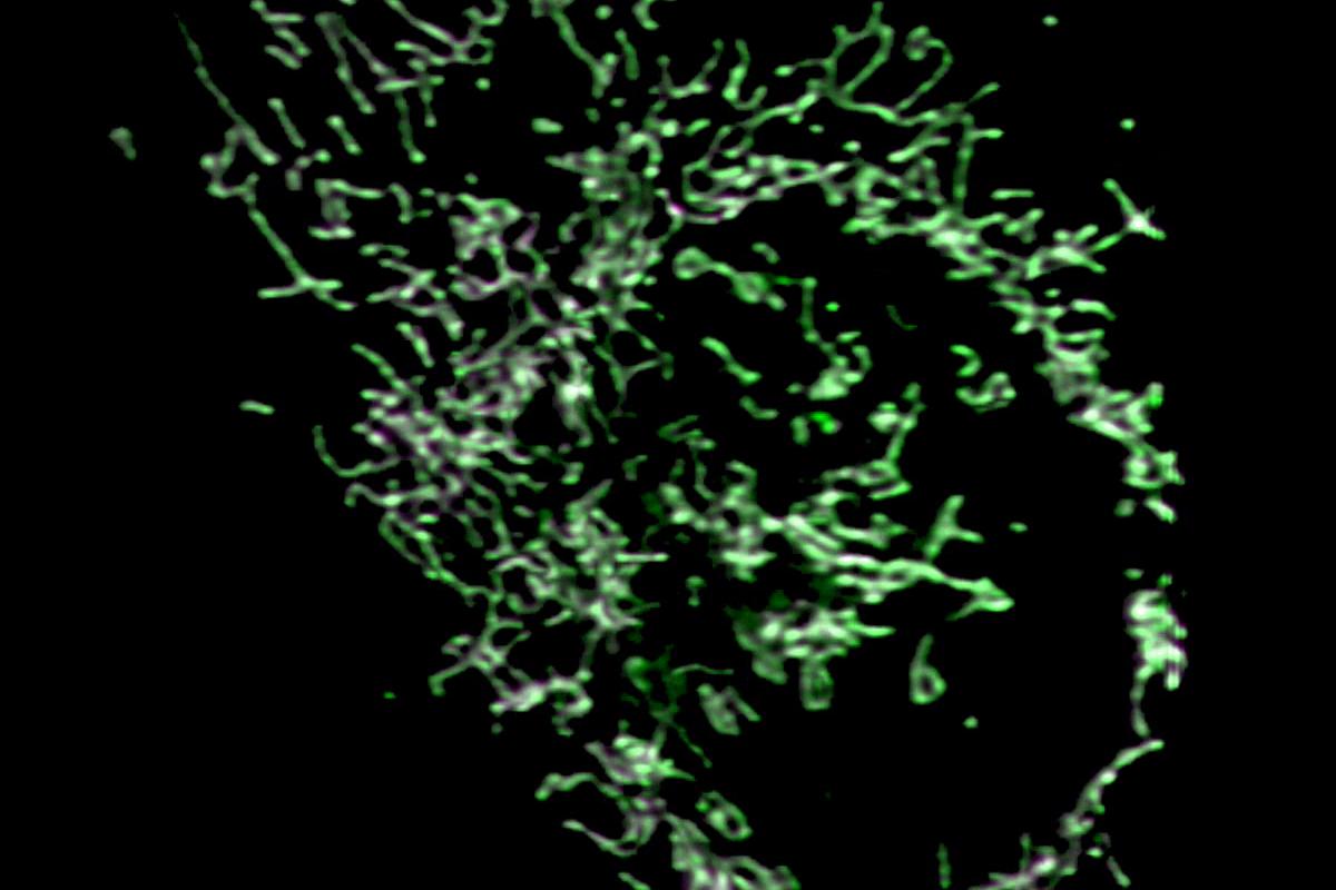 U2OS细胞用MitoTracker Green（绿色）和MitoTracker Red CMXRos（品红色）染色。