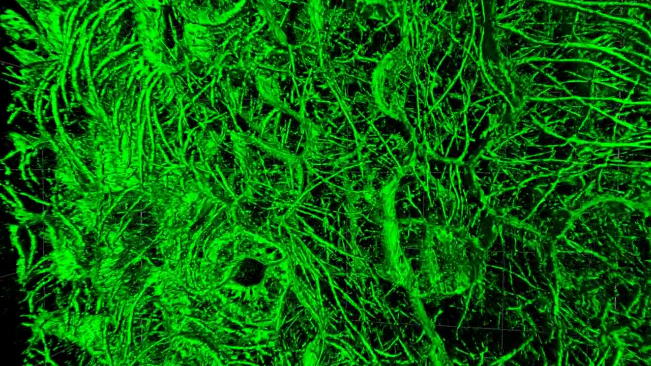 对活体拟南芥样品的叶片进行SIM² Apotome三维成像，显示了上三层细胞层中的微管（微管蛋白-GFP）。