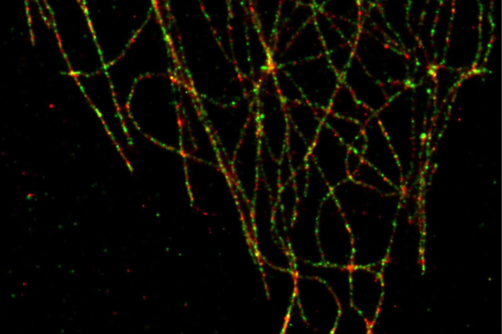 SMLM：α-微管蛋白采用Alexa 555标记，β-微管蛋白采用Alexa 488标记。