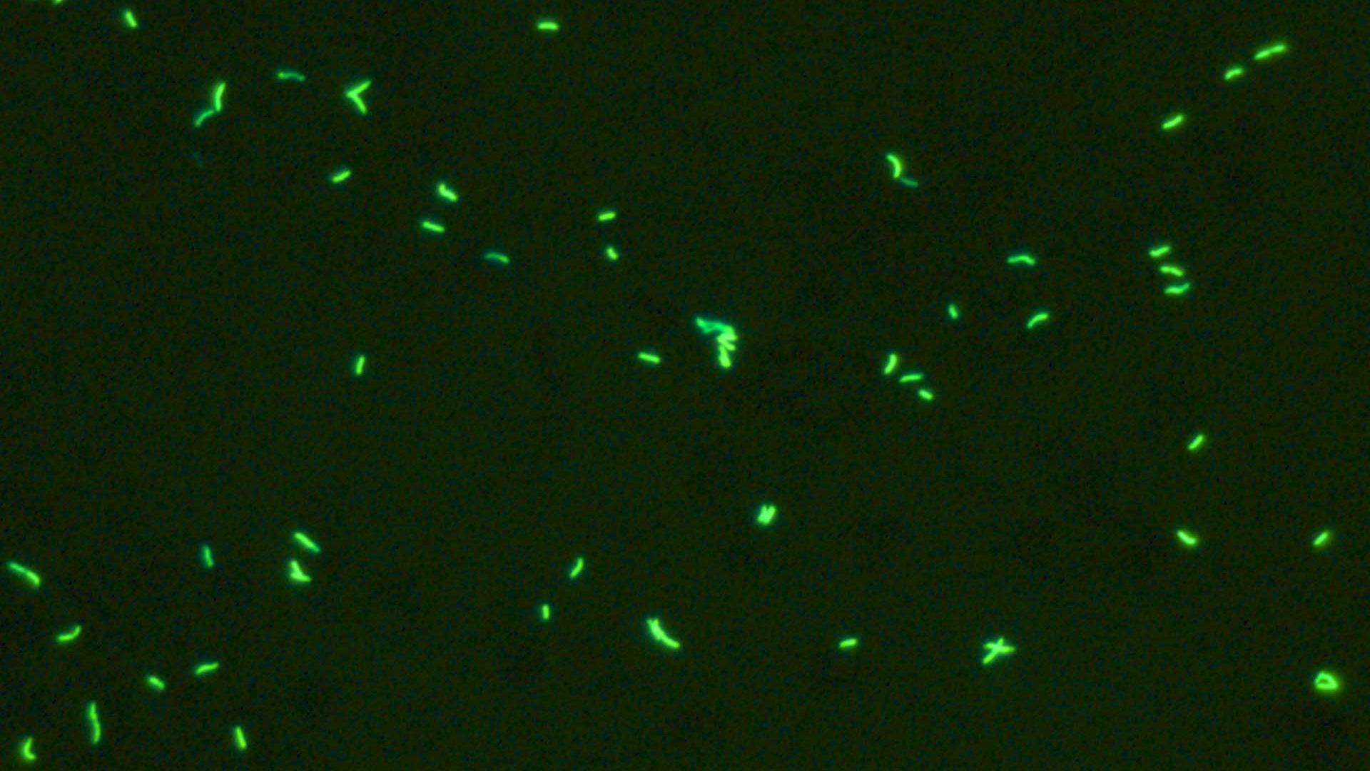 结核分枝杆菌荧光，采用金胺和丙交钾染色，Primo Star iLED