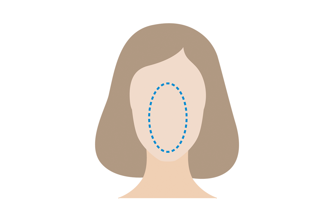 Longitudinal or rectangular faces